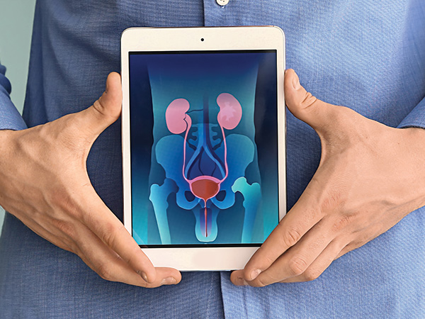 man holding tablet with medical diagram of kidneys, bladder and prostate