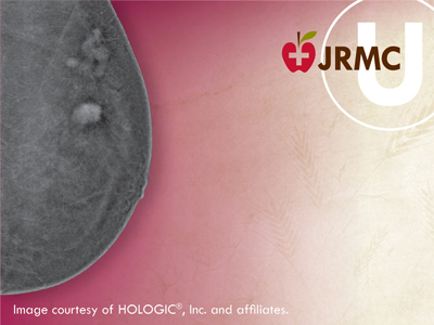 JRMC U: High Contrast, Clearer Mammograms