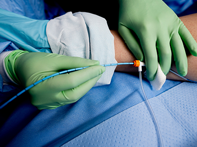 Image of vein treatment