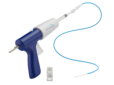 venaseal-system-jrmc-vein-treatment Image of VenaSeal